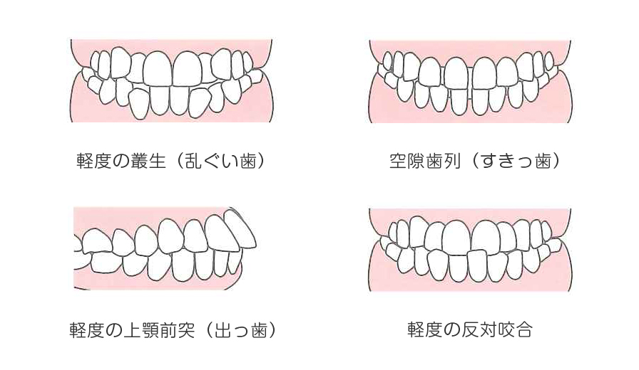 アソアライナー