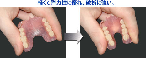 軽くて弾力性に優れ、破折に強い